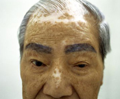 Guillaume Herbaut // Hiroshima guillaume herbaut, hiroshima, atom bomb, A-bomb, survivor, hibakushas, atomic bomb, nuclear bomb, disease, war, world war two, WWII, world war 2,